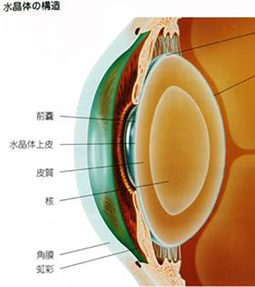 白内障とは