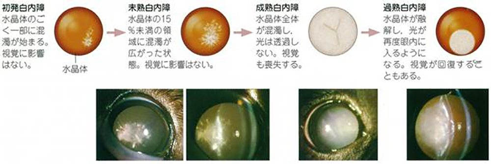 白内障の検査