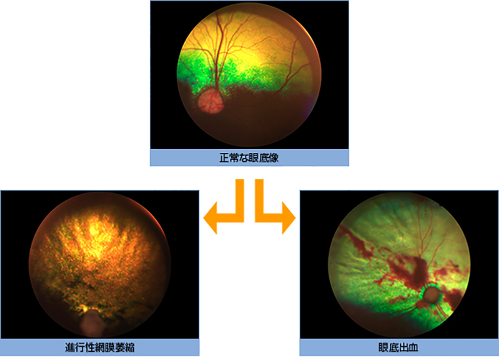 5 眼底検査法