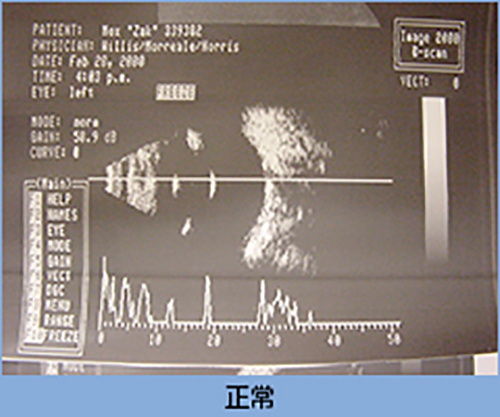 6 超音波画像診断